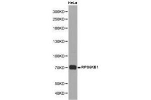 Western Blotting (WB) image for anti-Ribosomal Protein S6 Kinase, 70kDa, Polypeptide 1 (RPS6KB1) antibody (ABIN1874663) (RPS6KB1 antibody)