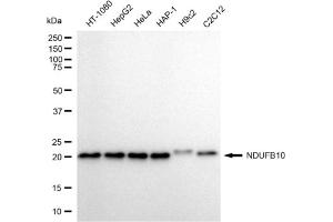 Western blotting analysis using NDUFB10 antibody (ABIN7799547). (NDUFB10 antibody)