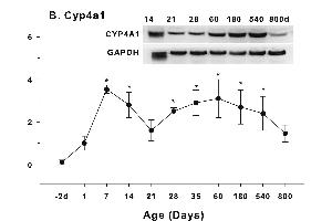 Age-related expression of CYP-4 family gene/proteins in livers of male rats. (CYP4A11 antibody  (AA 351-450))