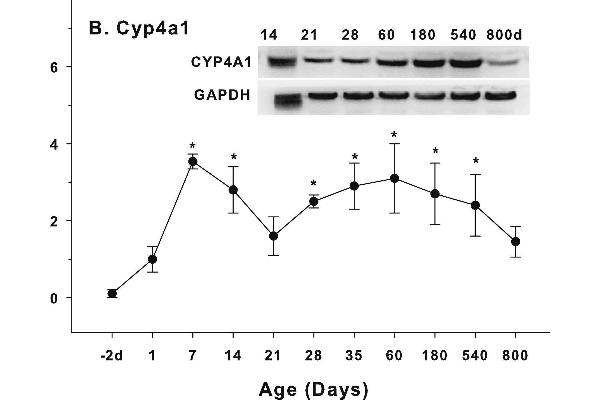 CYP4A11 antibody  (AA 351-450)