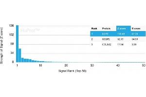 Analysis of Protein Array containing more than 19,000 full-length human proteins using Estrogen Receptor alpha Mouse Monoclonal Antibody (ESR1/3559) Z- and S- Score: The Z-score represents the strength of a signal that a monoclonal antibody (MAb) (in combination with a fluorescently-tagged anti-IgG secondary antibody) produces when binding to a particular protein on the HuProtTM array. (Estrogen Receptor alpha antibody  (AA 129-312))