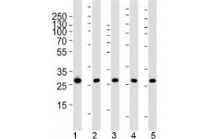 Western blot analysis of lysate from 1) 293, 2) MCF-7, 3) HepG2, 4) mouse NIH3T3 cell line and 5) rat liver tissue using PHB1 antibody at 1:1000. (Prohibitin antibody)