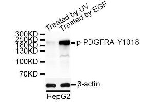 Western blot analysis of extracts of HepG2 cells, using Phospho-PDGFRA-Y1018 antibody. (PDGFRA antibody  (pTyr1018))