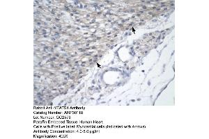 Immunohistochemistry (IHC) image for anti-YEATS Domain Containing 4 (Middle Region) antibody (ABIN2779287) (GAS41 antibody  (Middle Region))