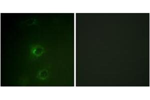 Immunofluorescence analysis of COS7 cells, using CBL (Ab-700) Antibody. (CBL antibody  (AA 666-715))