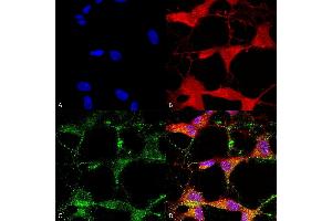 Immunocytochemistry/Immunofluorescence analysis using Mouse Anti-TrpV3 Monoclonal Antibody, Clone S15-39 (ABIN2485235). (TRPV3 antibody  (AA 458-474) (Atto 594))