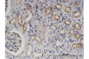 Immunoperoxidase of monoclonal antibody to SERPINB9 on formalin-fixed paraffin-embedded human kidney.