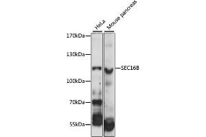 Western blot analysis of extracts of various cell lines, using SEC16B antibody (ABIN6292556) at 1:1000 dilution. (SEC16B antibody)