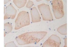 DAB staining on IHC-P; Samples: Rat Skeletal muscle Tissue (BMP15 antibody  (AA 269-391))