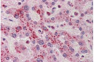 Human Liver: Formalin-Fixed, Paraffin-Embedded (FFPE) (NDRG2 antibody  (C-Term))