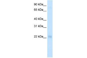 WB Suggested Anti-CSRP3 Antibody   Titration: 2. (CSRP3 antibody  (Middle Region))