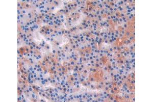 IHC-P analysis of adrenal gland tissue, with DAB staining. (IL-17 antibody  (AA 18-150))