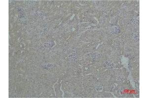 Immunohistochemical analysis of paraffin-embedded Mouse Kidney Tissue using ZBTB45 Polyclonal Antibody. (ZBTB45 antibody)
