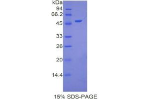SDS-PAGE analysis of Human Apolipoprotein A5 Protein.