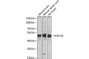 Western blot analysis of extracts of various cell lines using PHF21B Polyclonal Antibody at dilution of 1:1000. (PHF21B antibody)