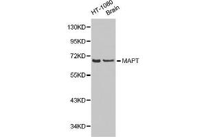 Western Blotting (WB) image for anti-Microtubule-Associated Protein tau (MAPT) (AA 1-100) antibody (ABIN6215045) (MAPT antibody  (AA 1-100))