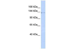WB Suggested Anti-ZNF445 Antibody Titration:  0. (ZNF445 antibody  (Middle Region))