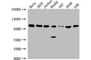 Western Blot Positive WB detected in: Hela whole cell lysate, 293T whole cell lysate, Jurkat whole cell lysate, HepG2 whole cell lysate, U87 whole cell lysate, A549 whole cell lysate, LO2 whole cell lysate All lanes: ADAR antibody at 1:2000 Secondary Goat polyclonal to rabbit IgG at 1/50000 dilution Predicted band size: 137, 134, 132, 141, 104 kDa Observed band size: 104 kDa (ADAR antibody  (AA 367-471))