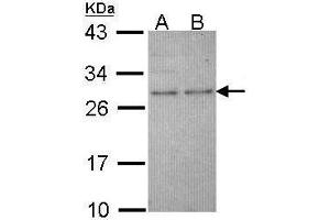 WB Image Sample (30 ug of whole cell lysate) A: Molt-4 , B: Raji 12% SDS PAGE antibody diluted at 1:1000 (HPRT1 antibody)