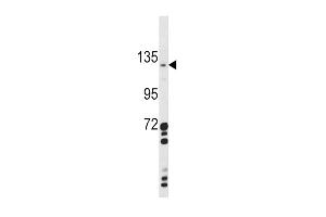 Western Blotting (WB) image for anti-C-Type Lectin Domain Family 16, Member A (CLEC16A) (AA 365-391) antibody (ABIN390971)