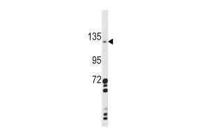 Western blot analysis of CLEC16A Antibody (Center) (ABIN390971 and ABIN2841151) in  cell line lysates (35 μg/lane). (CLEC16A antibody  (AA 365-391))