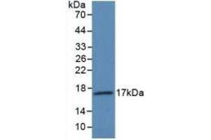 Detection of Recombinant VEGF145, Human using Polyclonal Antibody to Vascular Endothelial Growth Factor 145 (VEGF145) (Vascular Endothelial Growth Factor 145 (AA 28-147) antibody)