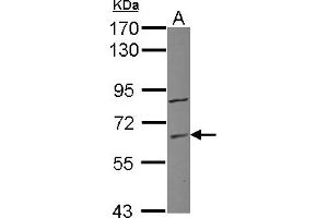 Western Blotting (WB) image for anti-Zinc Finger Protein 282 (ZNF282) (AA 46-303) antibody (ABIN1501833) (ZNF282 antibody  (AA 46-303))