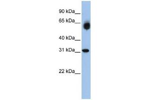 WB Suggested Anti-DHRS2 Antibody Titration:  0. (DHRS2 antibody  (Middle Region))