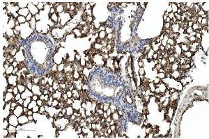 IHC analysis of Caveolin-2/CAV2 using anti Caveolin-2/CAV2 antibody (ABIN7601170). (Caveolin 2 antibody  (AA 3-162))