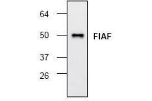 Image no. 1 for anti-Angiopoietin-Like 4 (ANGPTL4) antibody (ABIN127156)