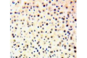 IHC-P analysis of Liver tissue, with DAB staining. (GTF2H1 antibody  (AA 84-335))