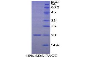 SDS-PAGE (SDS) image for Peptidylprolyl Isomerase F (PPIF) (AA 45-196) protein (His tag) (ABIN2126255)