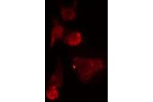 ABIN6275531 staining  HepG2 cells by IF/ICC. (NEK7 antibody  (Internal Region))