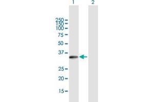 Western Blot analysis of LDB3 expression in transfected 293T cell line by LDB3 MaxPab polyclonal antibody.
