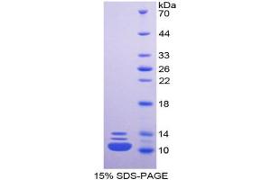 SDS-PAGE analysis of Human HNRPA2B1 Protein.