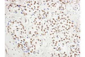 Immunohistochemistry (IHC) image for anti-Lysine (K)-Specific Demethylase 1A (KDM1A) (AA 50-100) antibody (ABIN7454595)
