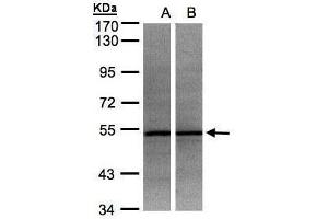 WB Image Sample(30 ug whole cell lysate) A:HeLa S3, B:MOLT4 , 7. (ADPGK antibody)