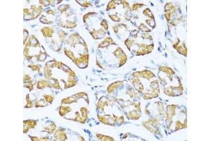 Immunohistochemistry of paraffin-embedded Human stomach using NDUFA5 Polyclonal Antibody at dilution of 1:100 (40x lens). (NDUFA5 antibody)