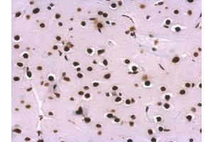 Immunohistochemistry (IHC) image for anti-Small Nuclear Ribonucleoprotein Polypeptide A (SNRPA) (C-Term) antibody (ABIN2855118)