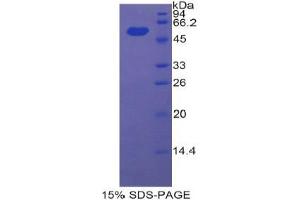 SDS-PAGE (SDS) image for Ectonucleotide Pyrophosphatase/phosphodiesterase 1 (ENPP1) (AA 568-793) protein (His tag,GST tag) (ABIN2122767) (ENPP1 Protein (AA 568-793) (His tag,GST tag))