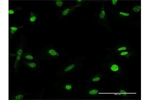 Immunofluorescence of purified MaxPab antibody to RFX5 on HeLa cell. (RFX5 antibody  (AA 1-616))
