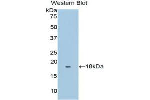 Western blot analysis of the recombinant protein. (Myoglobin antibody  (AA 1-154))