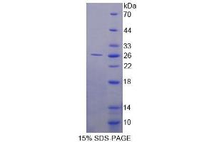 SDS-PAGE analysis of Human FBLN3 Protein. (FBLN3 Protein)