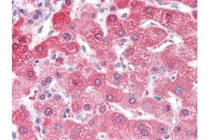 Human Liver (formalin-fixed, paraffin-embedded) stained with ALDH2followed by biotinylated goat anti-rabbit IgG secondary antibody, alkaline phosphatase-streptavidin and chromogen. (ALDH2 antibody  (N-Term))