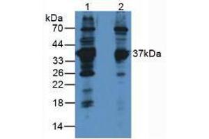 Western blot analysis of (1) Rat Brain Tissue and (2) Human Jurkat Cells. (LDHB antibody  (AA 1-334))