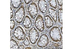 IHC analysis of hnRNP L/HNRNPL using anti-hnRNP L/HNRNPL antibody (ABIN7600130). (HNRNPL antibody  (AA 152-569))