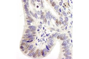 Immunohistochemistry (IHC) image for anti-Ubiquitin Specific Peptidase 28 (USP28) (AA 50-100) antibody (ABIN7448853)