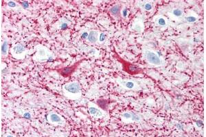 Human Brain, Cortex (formalin-fixed, paraffin-embedded) stained with MAP2 antibody ABIN239819 at 10 ug/ml followed by biotinylated anti-mouse IgG secondary antibody ABIN481714, alkaline phosphatase-streptavidin and chromogen. (MAP2 antibody)