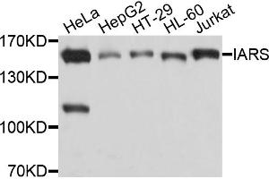 Western blot analysis of extracts of various cell lines, using IARS antibody. (IARS antibody)