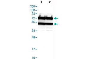 Western Blot analysis of Lane 1: RT-4 and Lane 2: U-251 MG sp cell lysates with CDC16 polyclonal antibody . (CDC16 antibody)
